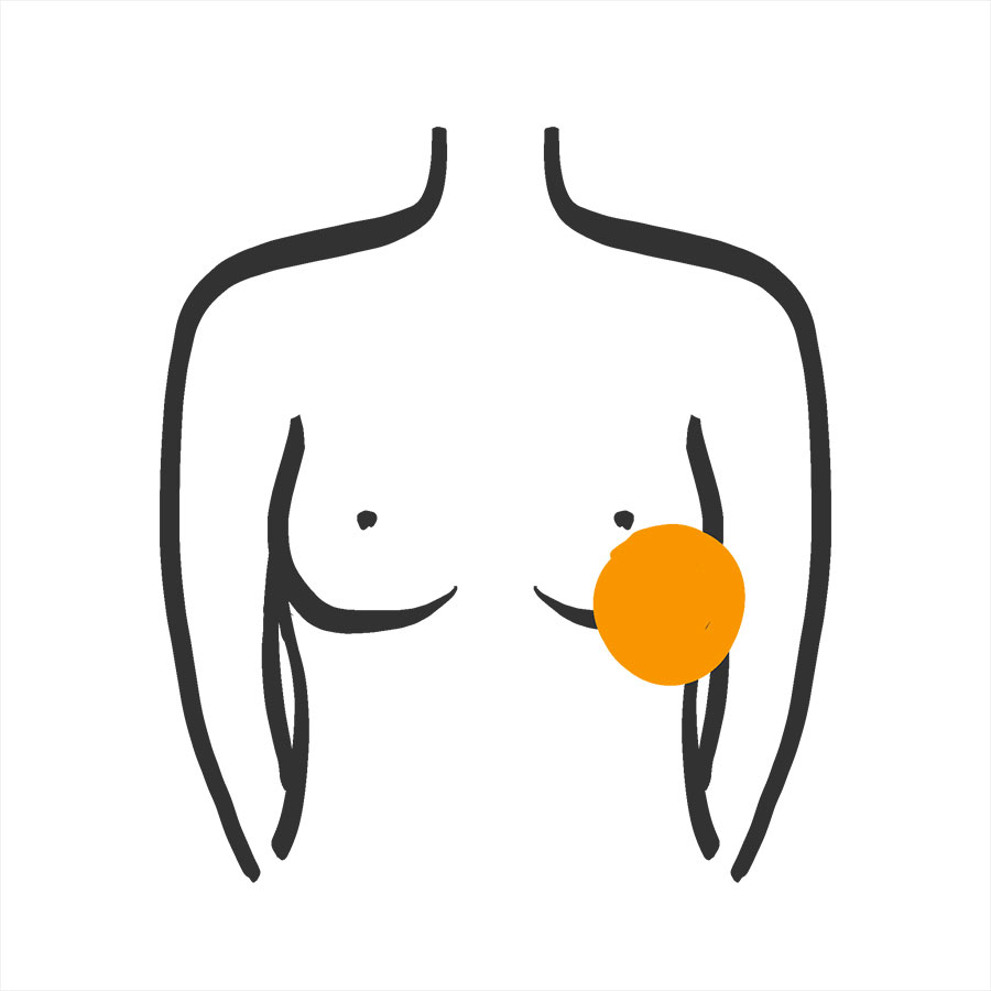 tratamientos5